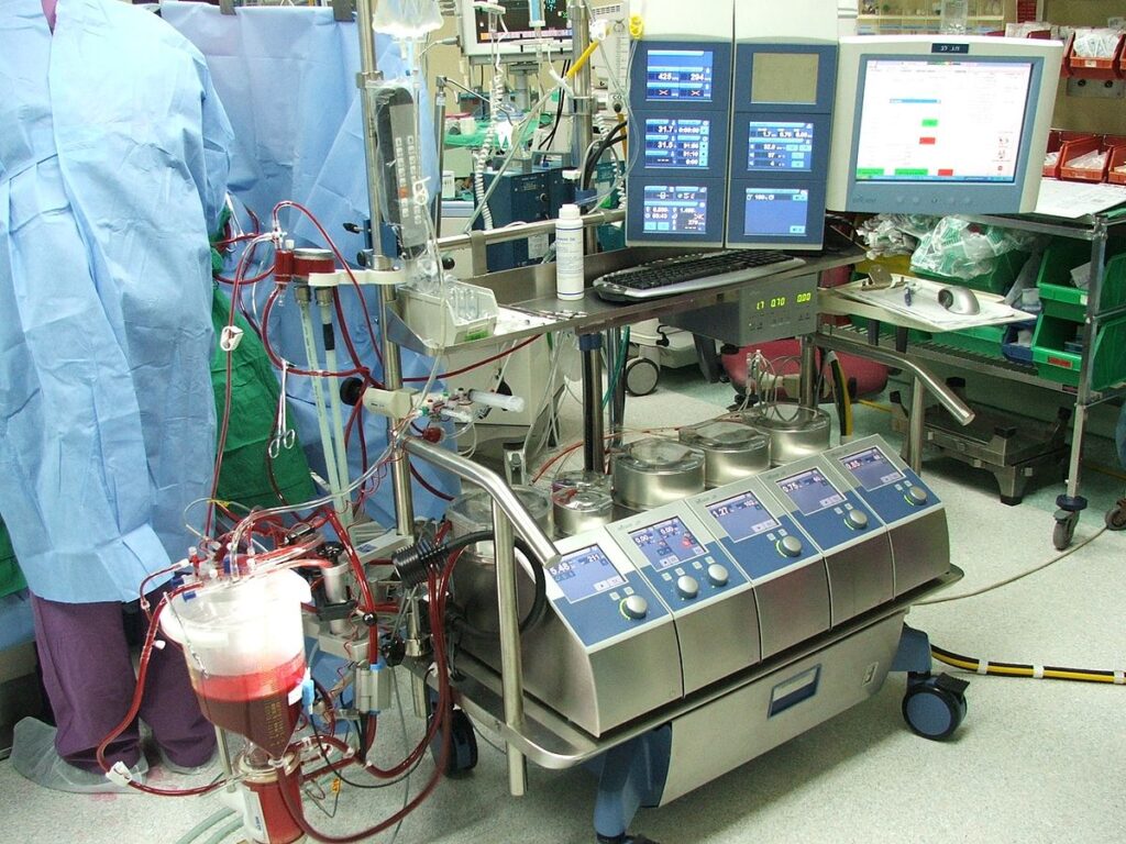 Cardiopulmonary Bypass System Market