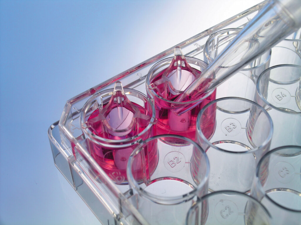 Cell Culture Media Market