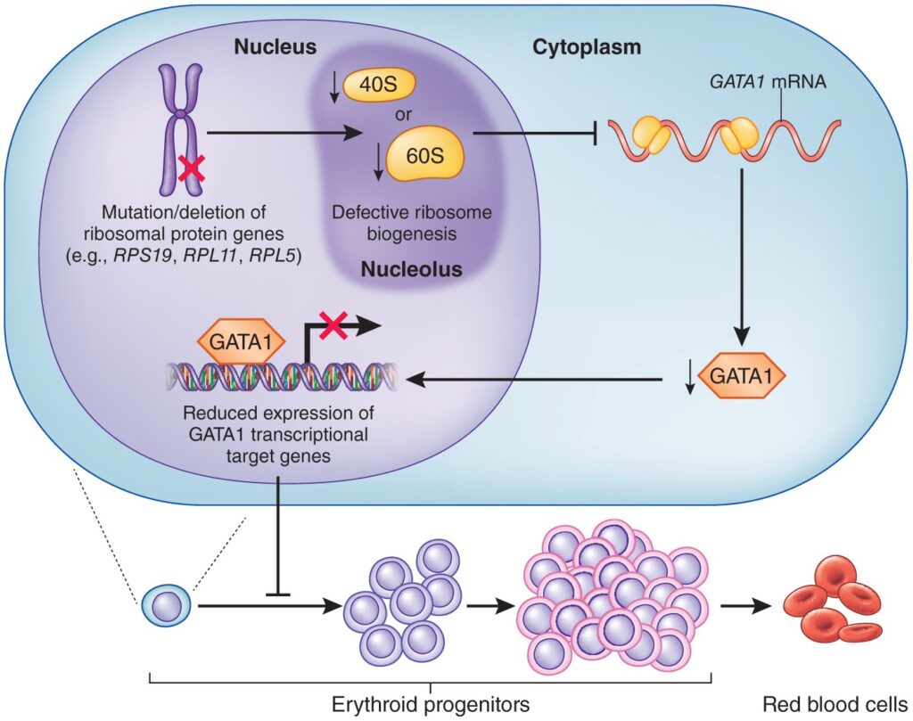 Diamond-Blackfan Anemia (DBAAASE) Syndrome Therapeutics Market