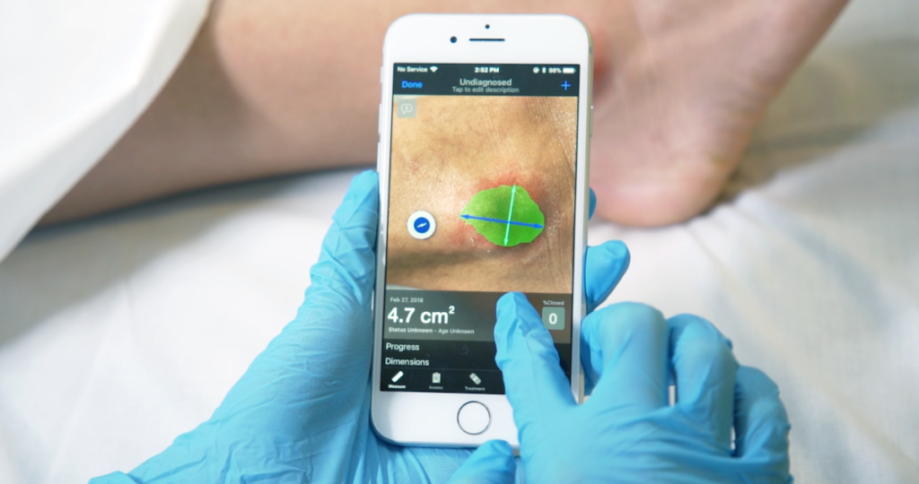 Digital Wound Measurement Devices Market