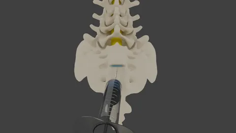 Epidural Guidance Systems Market