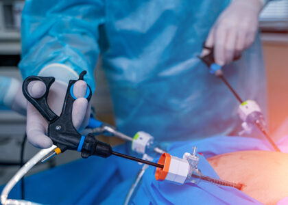 Global Bariatric Surgery Devices Industry