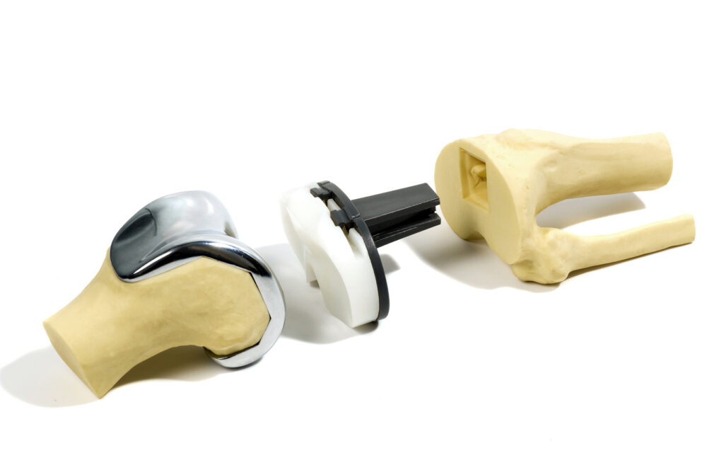 Joint Replacement Market