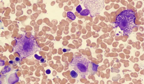 Managing Mast Cell Tumors Market