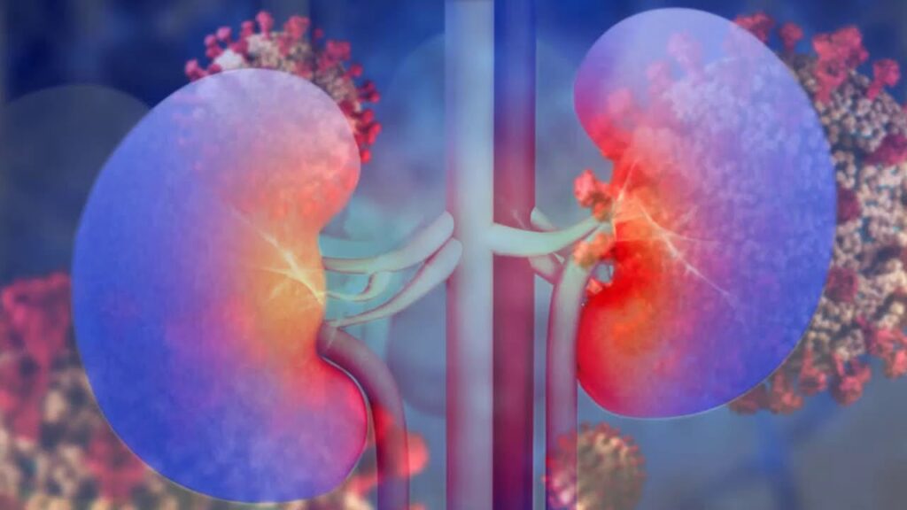 Acute Kidney Injury Treatment Market