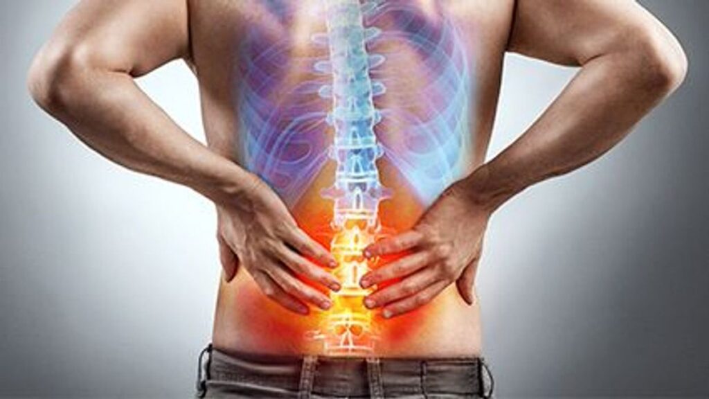 Ankylosing Spondylitis Treatment Market