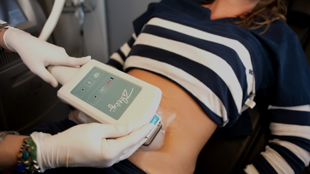 Body Slimming Device Market