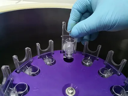 Cytocentrifuge Industry