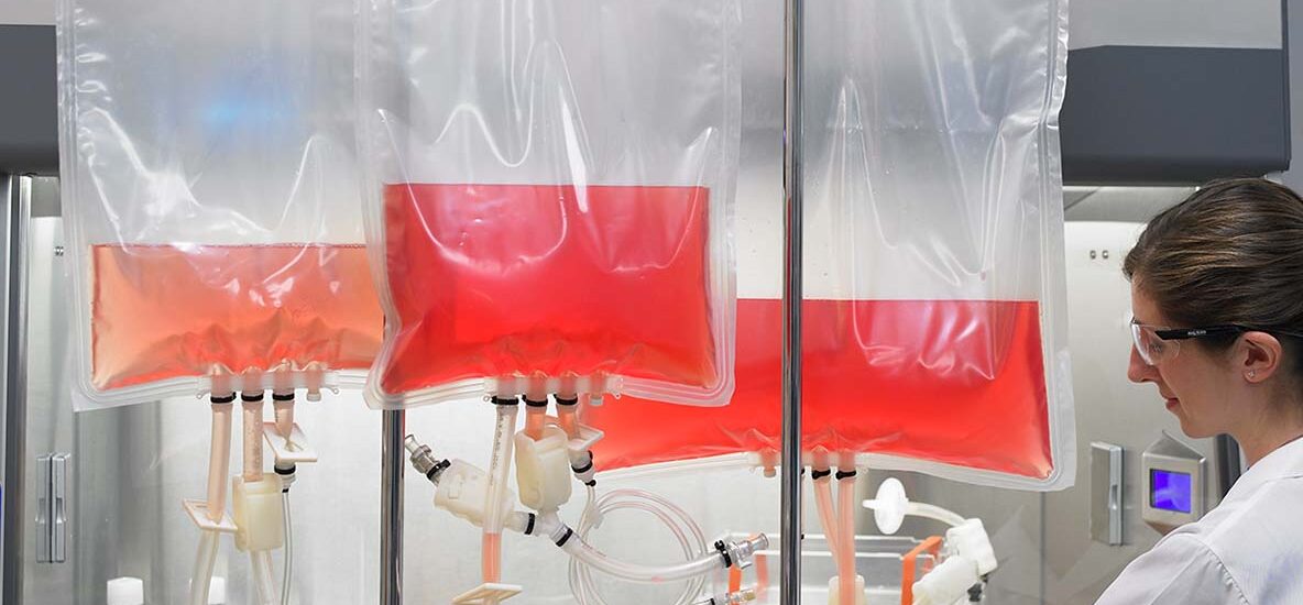 Global Cell Culture Media Bags Industry Poised for a Spectacular US