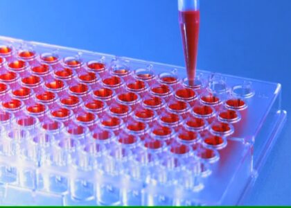 Global Immunoassay Industry