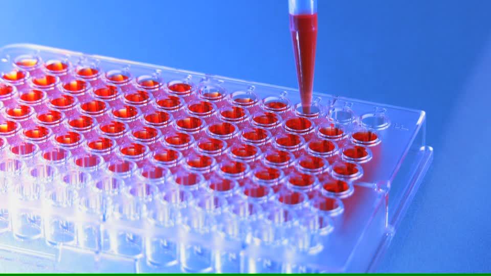 Global Immunoassay Industry