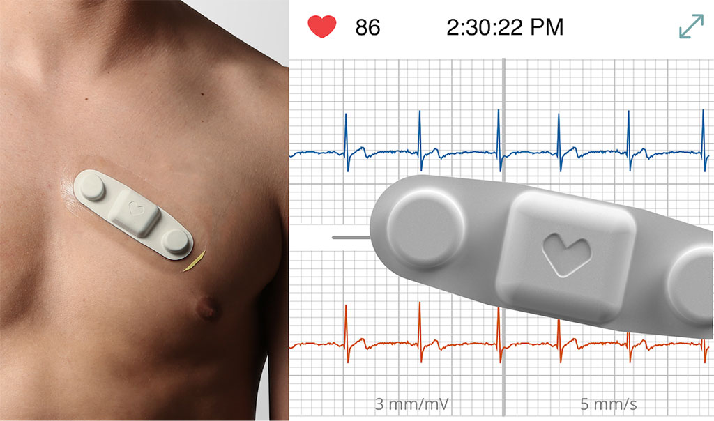  Global Multi-Channel Remote ECG Monitors Market