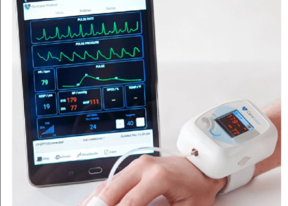 Global Wearable Blood Pressure Monitor Industry