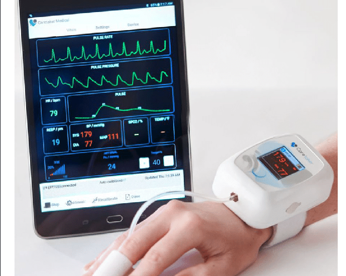 Global Wearable Blood Pressure Monitor Industry To Hit Us 8 Billion By