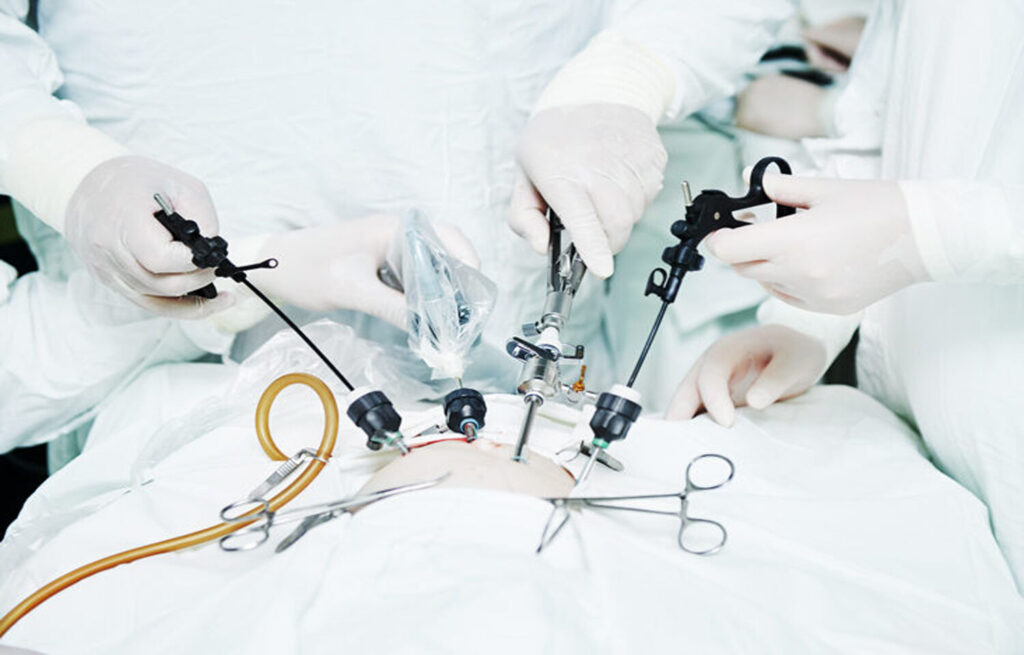 Laparoscopic Devices Market