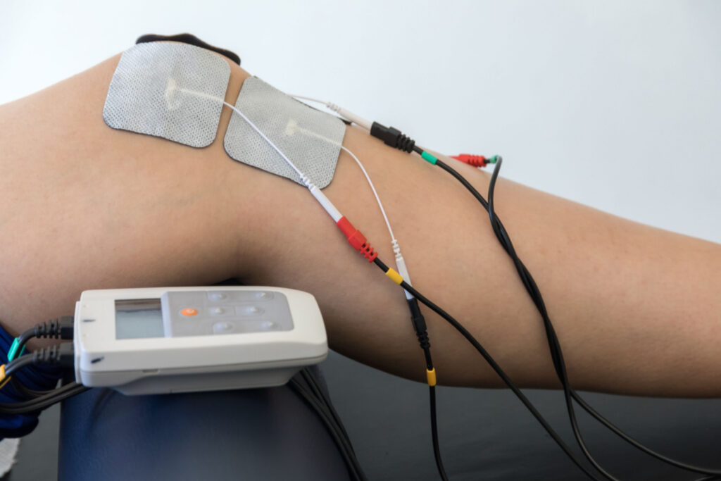 Muscle Stimulation Devices Industry