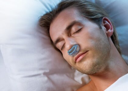 Global Sleep Apnea Implants Industry