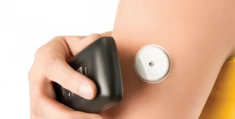 Continuous Glucose Monitoring Systems Market