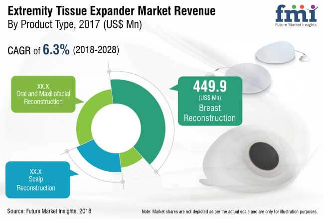 Global Extremity Tissue Expanders Industry