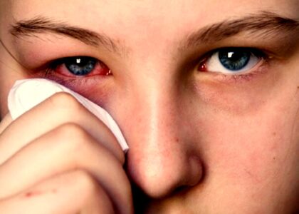 Global Eye Infections Treatment Industry