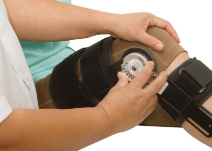 Global Orthopedic Trauma Device Industry