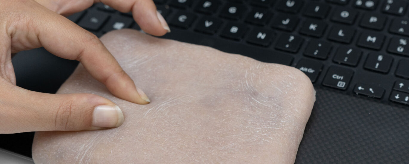 Global Regenerative Artificial Skin Industry