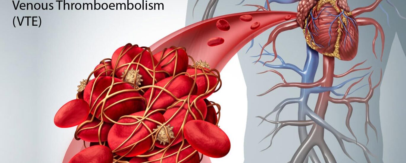 Global Venous Thromboembolism Treatment Industry