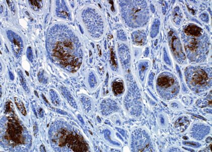 Immunohistochemistry Industry