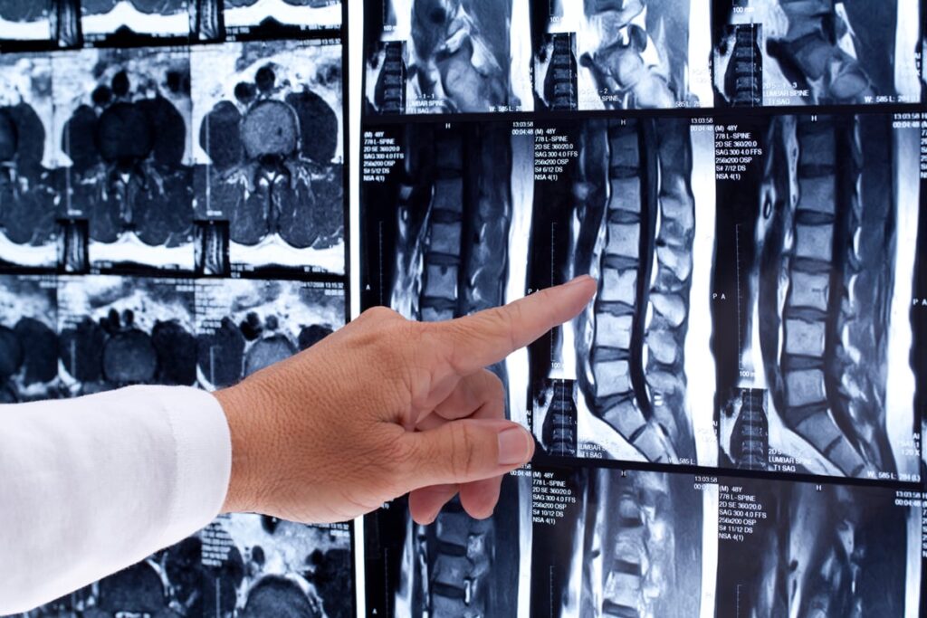Spinal Imaging Market