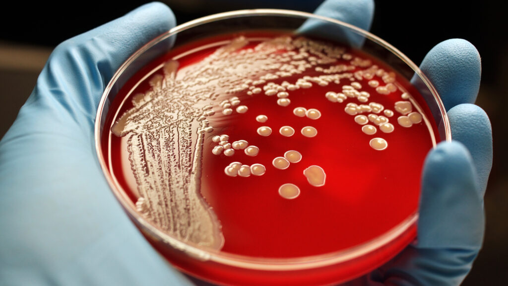 Methicillin-Resistant Staphylococcus Aureus (MRSA) Treatment Market