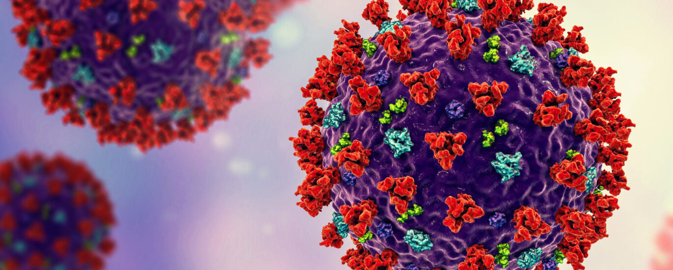 Global Monoclonal Gammopathy of Undermined Significance (MGUS