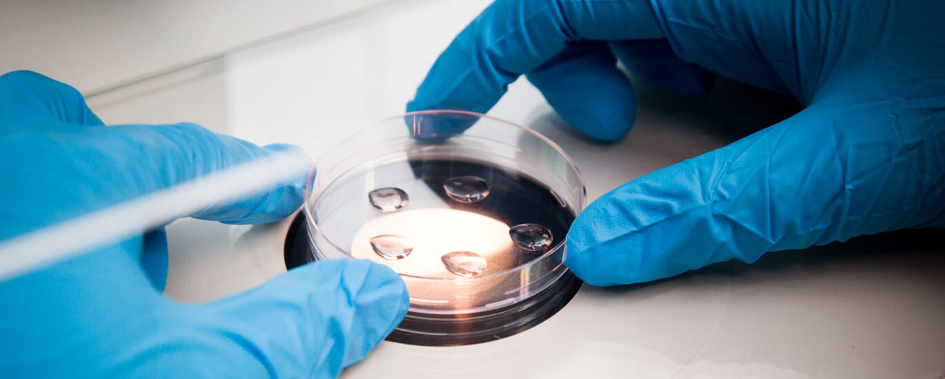 Pneumococcal Testing Market