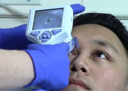 Global Pupillometer Industry