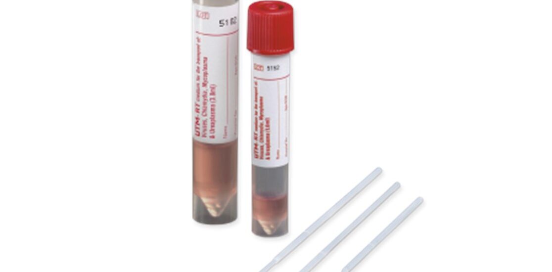 Global Swab and Viral Transport Medium Industry
