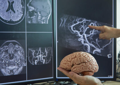 3D Printed Brain Model Market