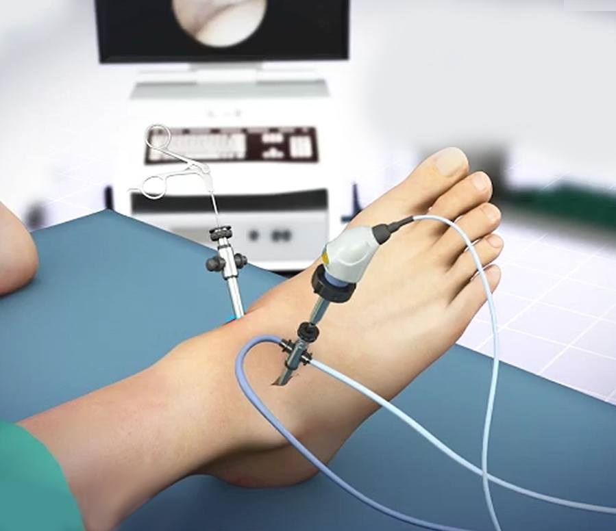 Arthroscopy Visualization Systems Market