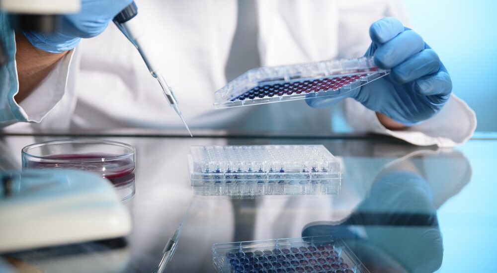 Clinical Immunodiagnostics Market