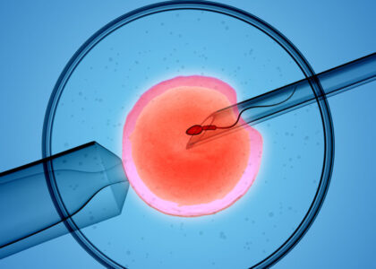 Global Animal Artificial Insemination Industry