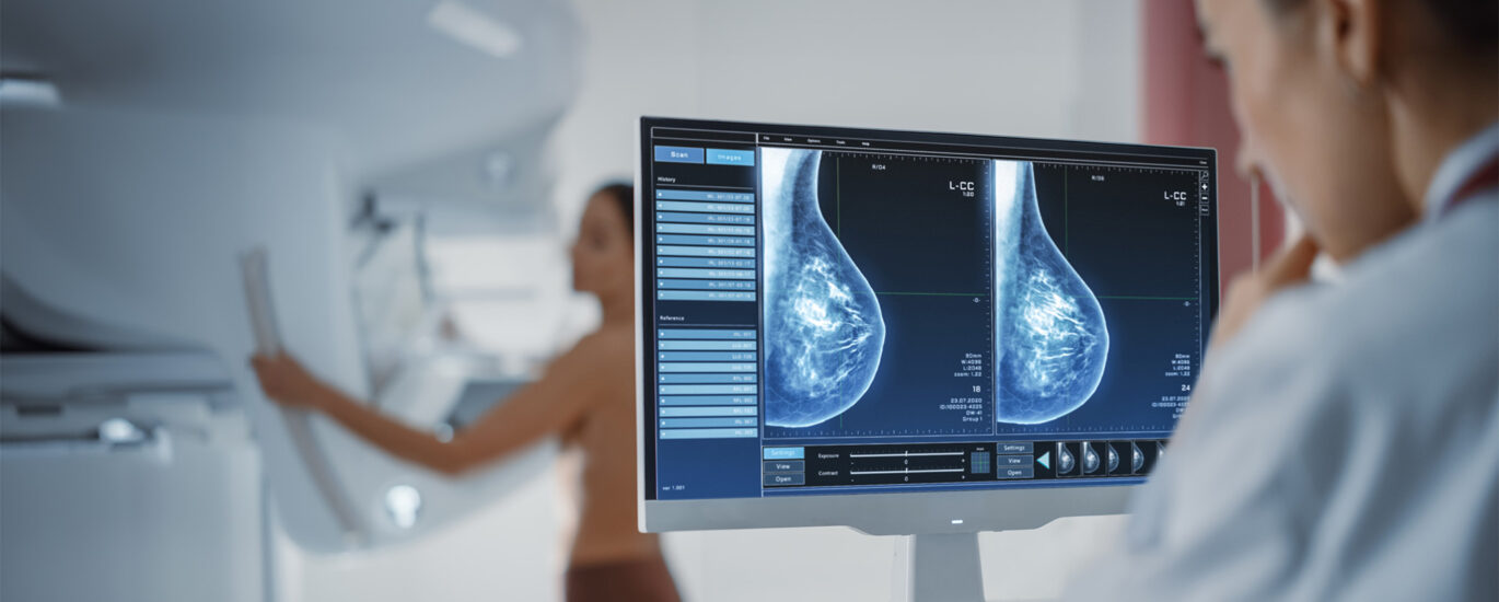 Global Breast Imaging Industry