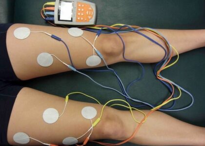 Global Functional Electrical Stimulation Industry