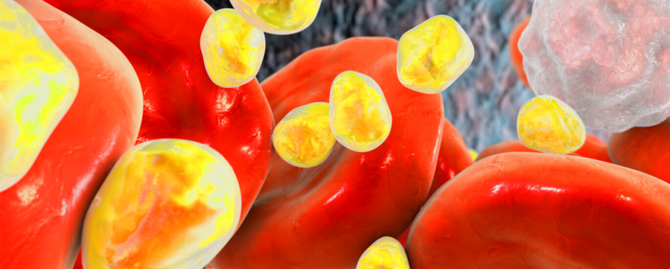 Global Heterozygous Familial Hypercholesterolemia Management Industry