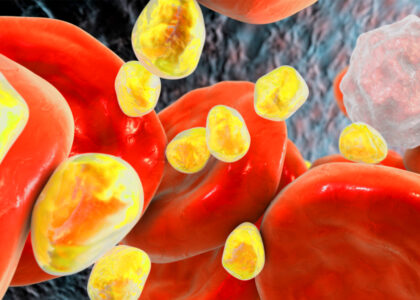 Global Heterozygous Familial Hypercholesterolemia Management Industry