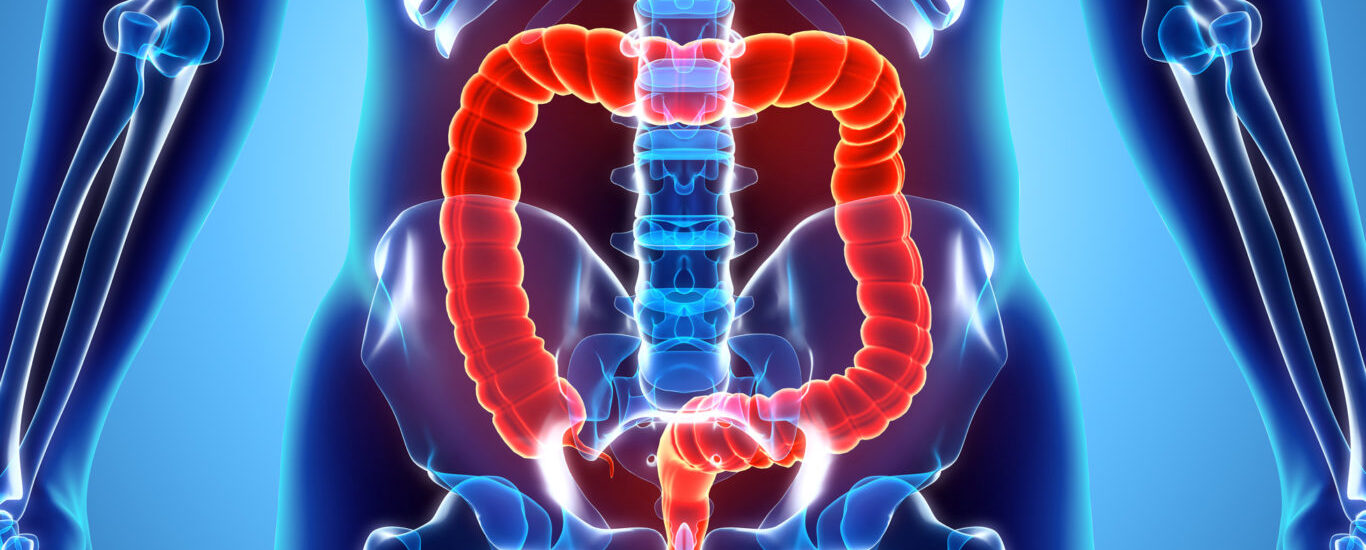 Global Intestinal Fistula Treatment Industry