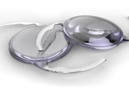 Global Intraocular Lens Industry