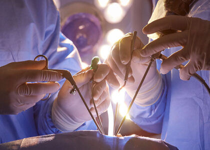 Global Minimally Invasive Neurosurgery Devices Industry