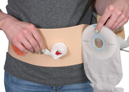 Global Stoma Ostomy Care Industry