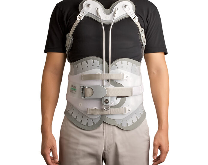 Global Thoracolumbar Stabilization Devices Industry