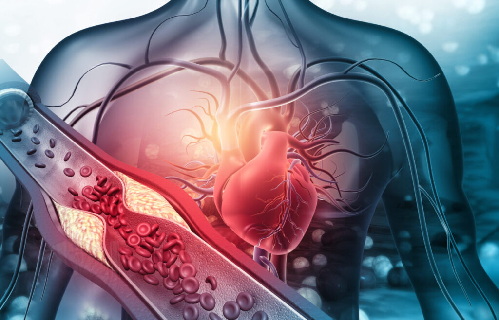 Heart Block Therapeutics Market