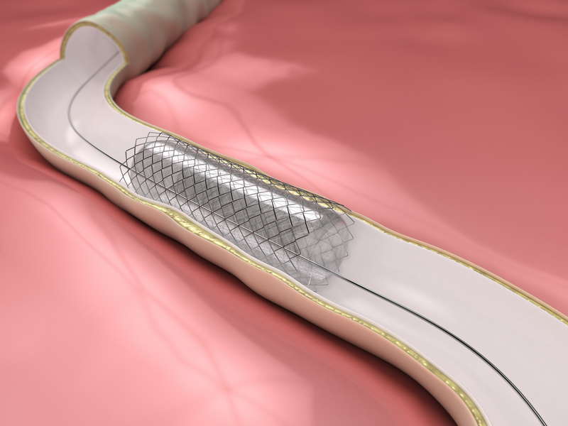 Peripheral Vascular Stent Market