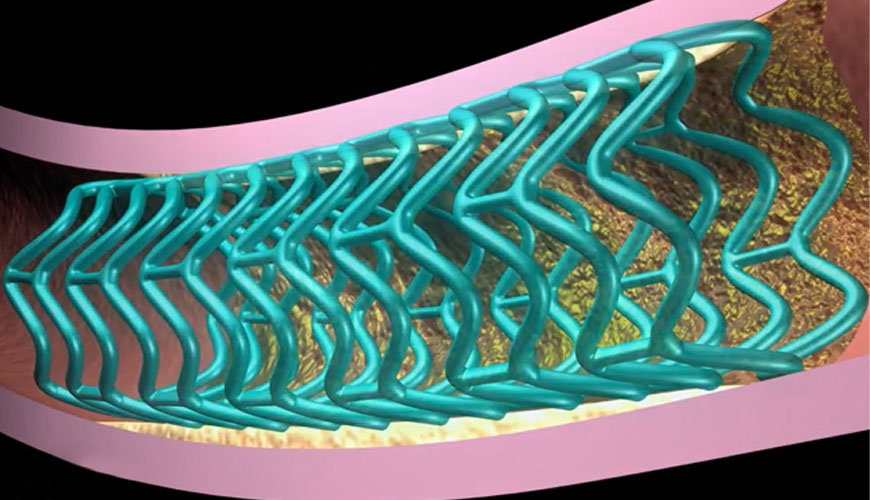 Bioabsorbable Stents Market